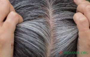 grey-hair-solution